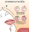 Kem trị nhiệt miệng Trinolone Oral Paste ảnh 2