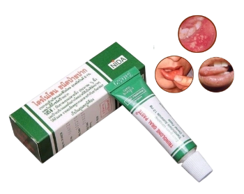 Ảnh sản phẩm Kem trị nhiệt miệng Trinolone Oral Paste 1