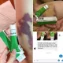 Gel giảmvết bầm tím viêm gân Meda Reparil Gel N ảnh 6