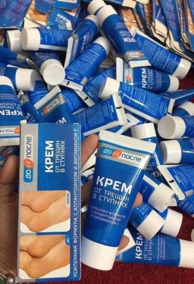 Kem dưỡng nứt gót chân Kpem OT Tpewnh B Ctynhrx Nga ảnh 6