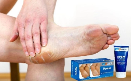 Kem dưỡng nứt gót chân Kpem OT Tpewnh B Ctynhrx Nga ảnh 10