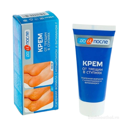 Kem dưỡng nứt gót chân Kpem OT Tpewnh B Ctynhrx Nga ảnh 1