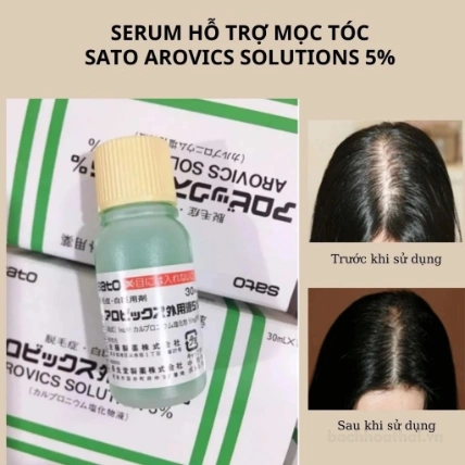 Kích mọc tóc hói đầu Sato Arovics Solutions Carpronium chloride 5% 30ml ảnh 8