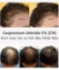 Kích mọc tóc điều trị bạch biến thảo dược Carpronium chloride 5% [CH] ảnh 5