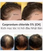 Ảnh sản phẩm Kích mọc tóc hói đầu Sato Arovics Solutions Carpronium chloride 5% 30ml 2