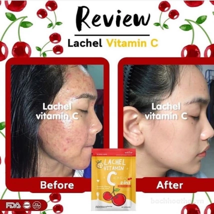 Viên uống trắng da giảm mụn thâm Lachel Vitamin C ảnh 2