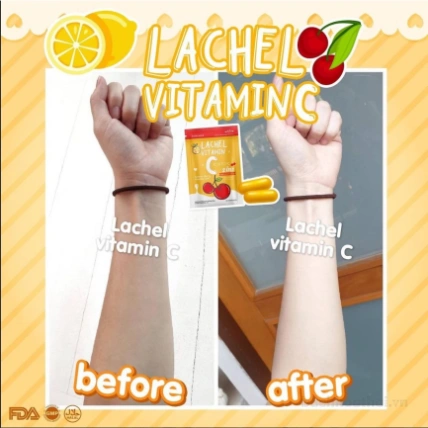 Viên uống trắng da giảm mụn thâm Lachel Vitamin C ảnh 22