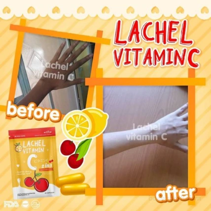 Viên uống trắng da giảm mụn thâm Lachel Vitamin C  ảnh 25