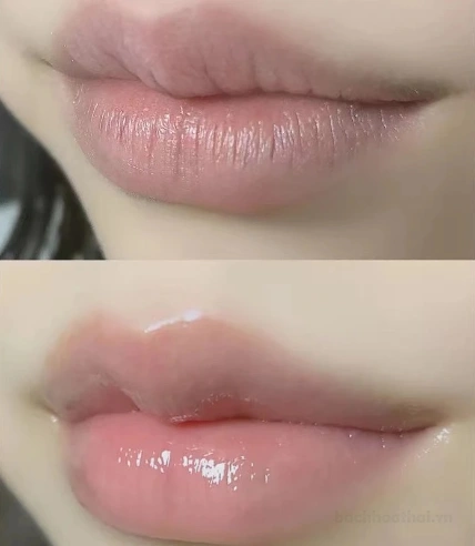 Son dưỡng ẩm làm hồng môi Vaseline Lip Therapy 7gr ảnh 2