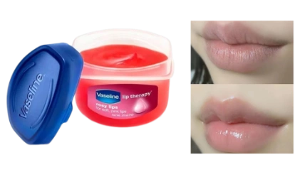 Son dưỡng ẩm làm hồng môi Vaseline Lip Therapy 7gr ảnh 1