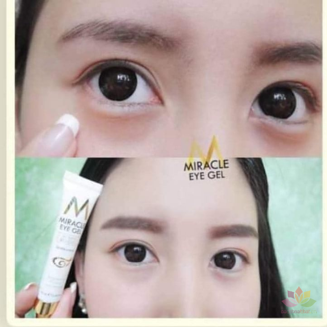 Kem trị thâm mắt Miracle Eye Gel Vitamin Ecriched ảnh 5