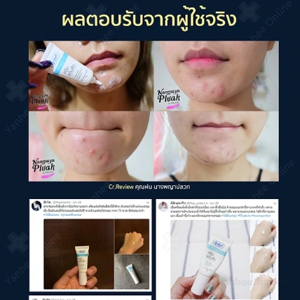 Kem trị mụn Yanhee Acne Cream Thái Lan ảnh 3