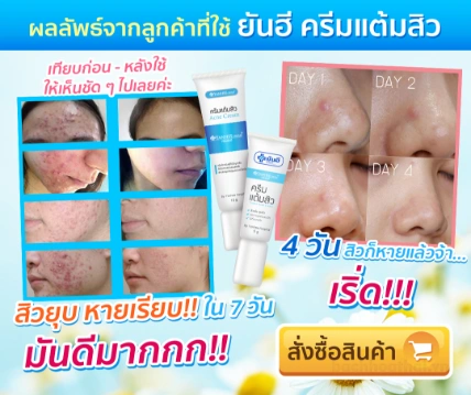 Kem trị mụn Yanhee Acne Cream Thái Lan ảnh 5