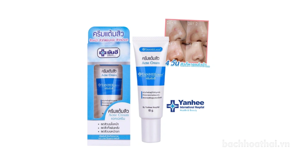 Yanhee Acne Cream có thể sử dụng hàng ngày hay chỉ khi cần thiết?
