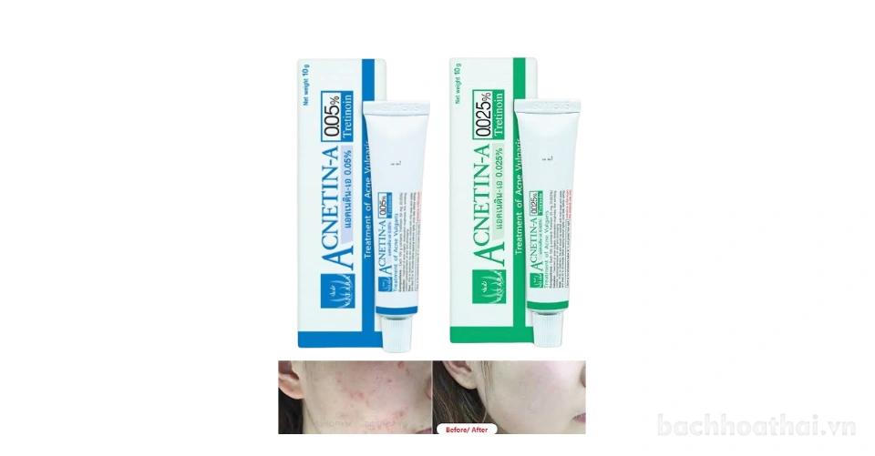 Kem thoa giảm mụn ẩn Vitara Acnetin-A Tretinoin Thái Lan