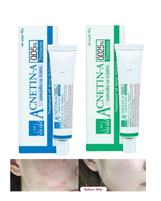 Kem thoa giảm mụn ẩn Vitara Acnetin-A Tretinoin Thái Lan