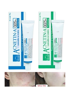 Ảnh sản phẩm Kem thoa giảm mụn ẩn Vitara Acnetin-A Tretinoin Thái Lan 1