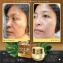 Kem dưỡng trắng da cho da nám, xạm Gold 24K whitening Anti-Melasma Facial Cream Thái Lan ảnh 2