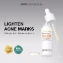 Bộ làm sạch, loại bỏ mụn SKINEVER SALICYLIC ACID  ảnh 15