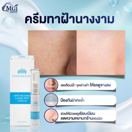 Kem đặc trị nám, tàn nhang Nangngam Anti-Melasma & Dark Spot Cream  ảnh 2