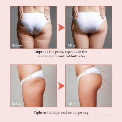 Kem nâng cơ và làm săn chắc ngực, mông Fteenply Shea Butter Hip Massage Cream 30g
ảnh 2