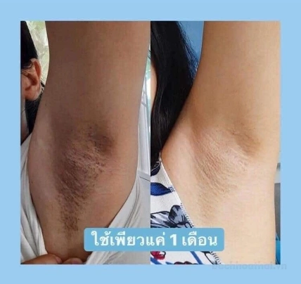 Kem khử thâm nách, mông, bẹn, bikini PURE Underarm care white Secret Toning Essence ảnh 8