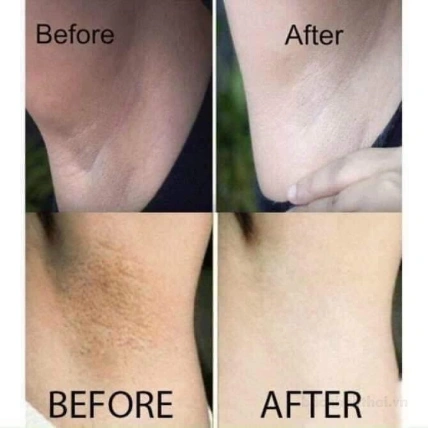 Kem khử thâm nách, mông, bẹn, bikini PURE Underarm care white Secret Toning Essence ảnh 16