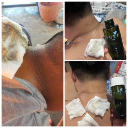 Tinh dầu tự nhiên khử thâm nách rạn da Pure oil ảnh 14