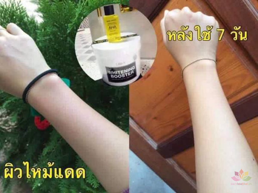 Serum kích trắng MIMI White Body Aha ảnh 8