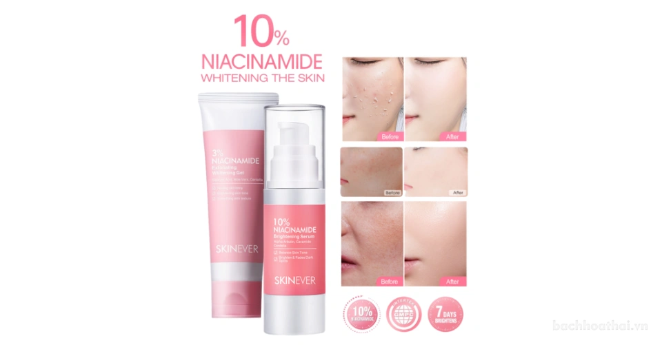 Serum, tẩy tế bào chết làm trắng giảm sắc tố trong 7 ngày SKINEVER 10% Niacinamide Brightening SE009