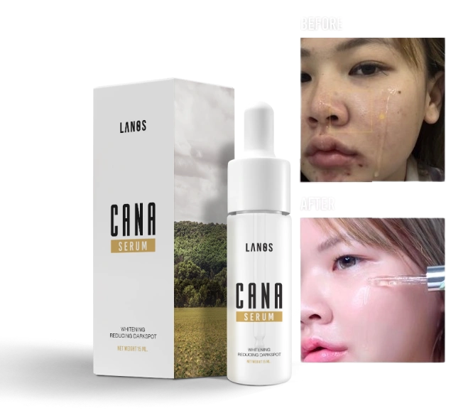 Serum dưỡng phục hồi da hư tổn do mụn Lanos Cana