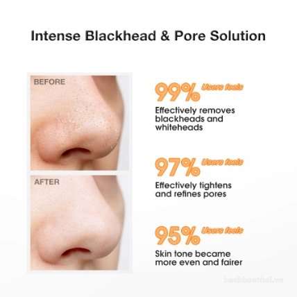 Combo loại bỏ mụn thu nhỏ lỗ chân lông Salicylic Acid Blackhead Purifying & Pore Minimizing Set ảnh 6