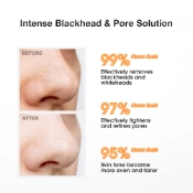 Ảnh sản phẩm Combo loại bỏ mụn thu nhỏ lỗ chân lông Salicylic Acid Blackhead Purifying & Pore Minimizing Set  2