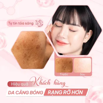 Ảnh sản phẩm Serum đều màu da Compliment B3 Niacinamide 10%, Vitamin C & Tranexamic Acid Serum 27ml 2