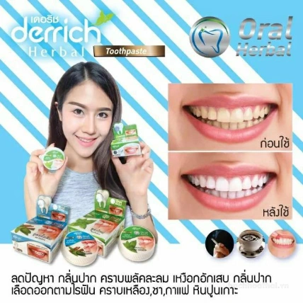 Kem tẩy trắng tăng Derrich Oral Herbal ảnh 5