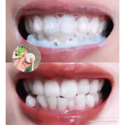 Kem tẩy trắng răng Derrich Oral Herbal Thái Lan ảnh 5