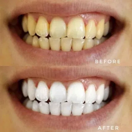 Kem tẩy trắng răng Derrich Oral Herbal Thái Lan ảnh 6