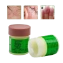 Kem mỡ trị nấm lang ben hắc lào eczema 29A ảnh 1