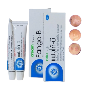 Ảnh sản phẩm Kem trị nấm da và lang ben Fango-B 1