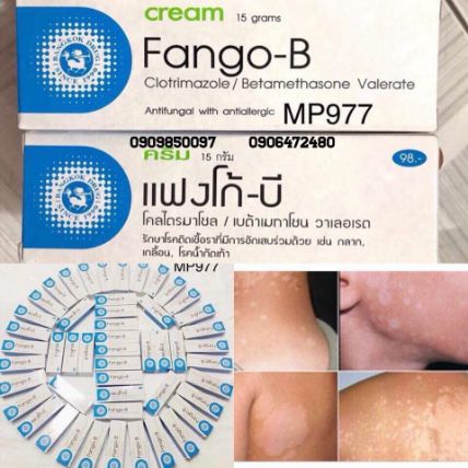 Kem trị nấm da và lang ben Fango-B ảnh 2