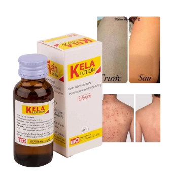 Ảnh sản phẩm KELA LOTION Dành cho da Viêm Lỗ Chân Lông Thái Lan 1