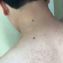 Kela Lotion đặc trị viêm lỗ chân lông ảnh 5