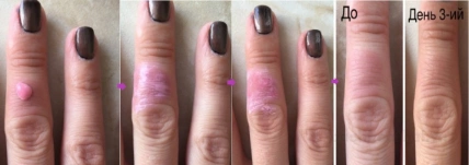 Lotion giảm kích ứng, ngứa, cháy nắng trên da Calamine Siribuncha Thái Lan ảnh 5