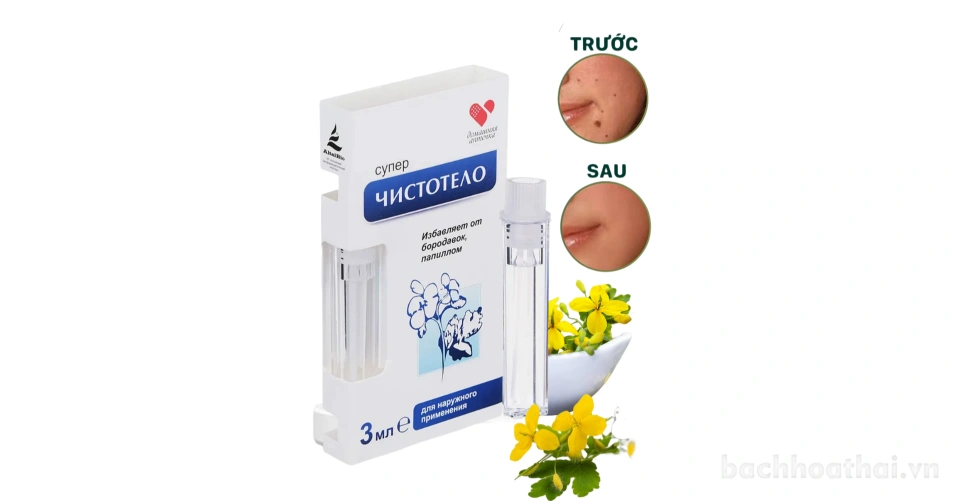 Gel Tẩy Nốt Ruồi DVELINIL Nga Tẩy Nốt Ruồi, Mụn Cơm, Mụn Cóc, Mụn Thịt Nga