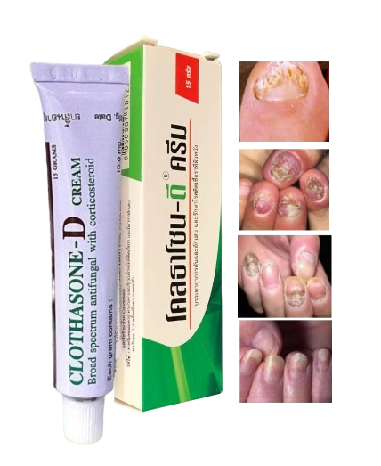Kem trị nấm móng Clothasone-D Cream 15gr Thái Lan ảnh 1