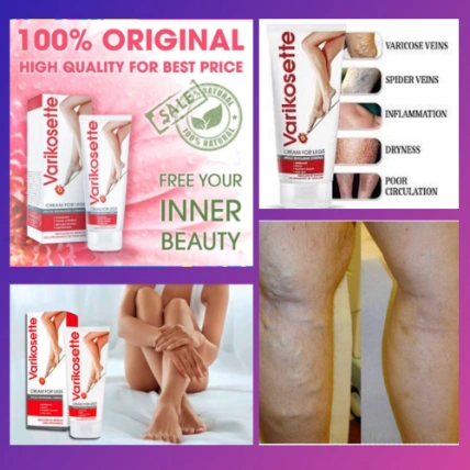 Kem bôi suy giãn tĩnh mạch Varikosette Cream For Legs Nga ảnh 5
