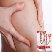 Ảnh sản phẩm Kem bôi suy giãn tĩnh mạch Varikosette Cream For Legs 2