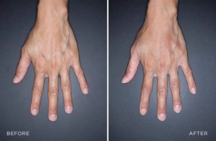 Kem dưỡng da tay chống nhăn giảm gân xanh Kpem Koppektop Nga ảnh 5