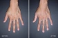 Kem dưỡng da tay chống nhăn giảm gân xanh Kpem Koppektop Nga ảnh 5