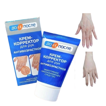 Ảnh sản phẩm Kem dưỡng da tay chống lão hóa giảm gân xanh Kpem Koppektop Nga 1